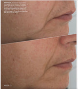 ZO PEPTIDE FACIAL REFINING CONCENTRATE